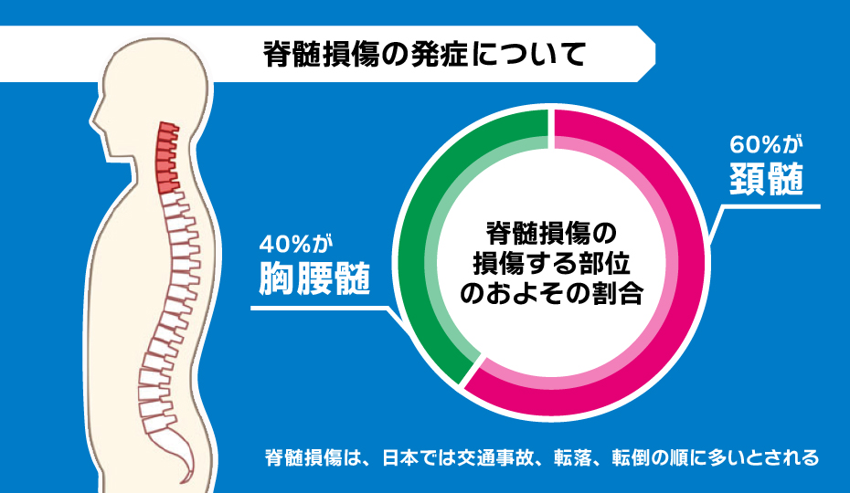 脊髄損傷の発症について