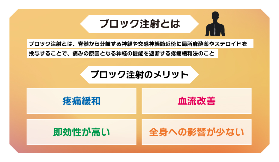 ブロック注射とは