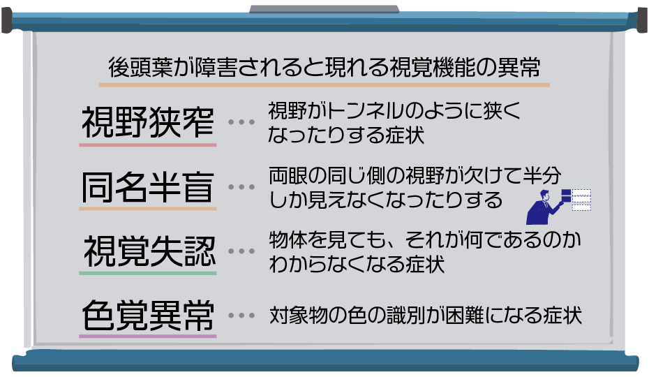 後頭葉が障害されると現れる視覚機能の異常