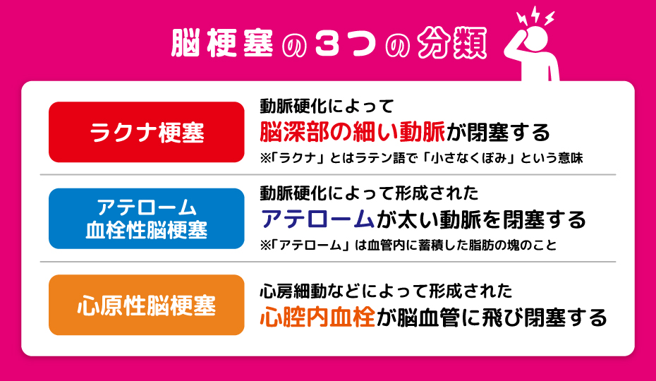 脳梗塞の3つの分類