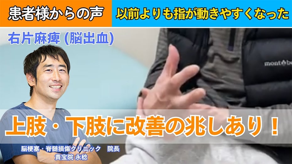 【60代男性|脳出血】車いすからの回復!上肢・下肢ともに改善がみられました!