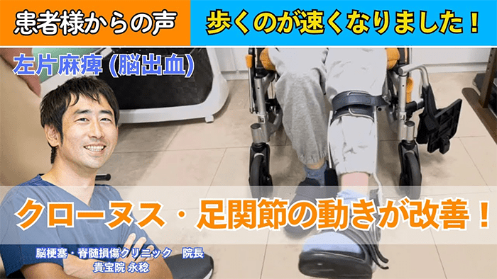 【40代女性|脳出血】痙性が減って歩く量やスピードもアップしました!